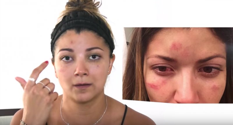 Turista acusa que fue golpeada en un hotel de Cancún; denuncia complicidad
