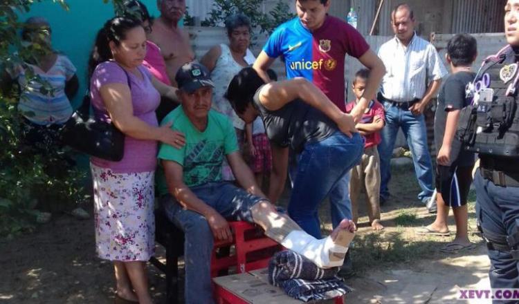 Motociclista se fractura una pierna al derrapar en la colonia Roberto Madrazo