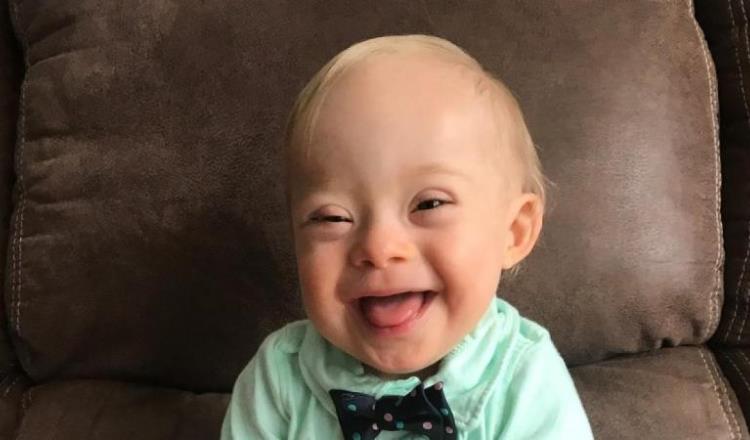 Lucas, primer bebé con síndrome de Down elegido como imagen de Gerber