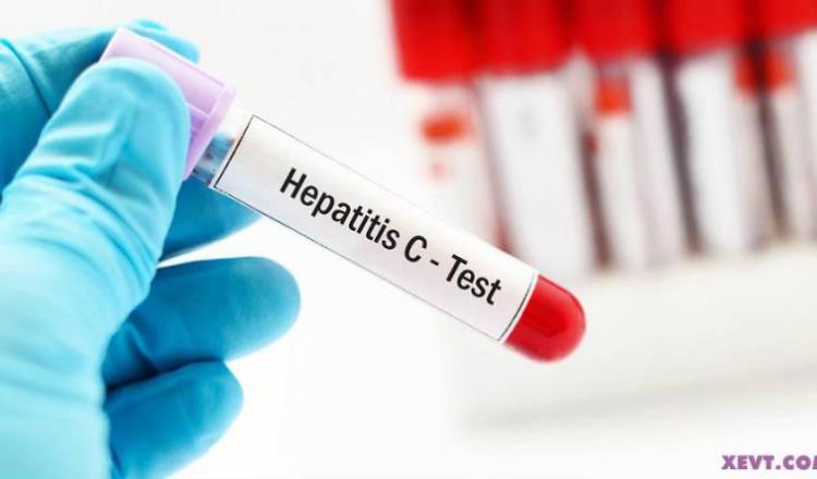 Anuncia Club Rotario aplicación de pruebas en el Rovirosa para detectar hepatitis