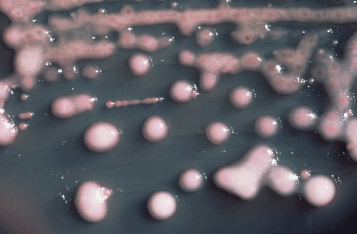 Bacteria klebsiella alcanza ahora a pacientes del IMSS, acusan