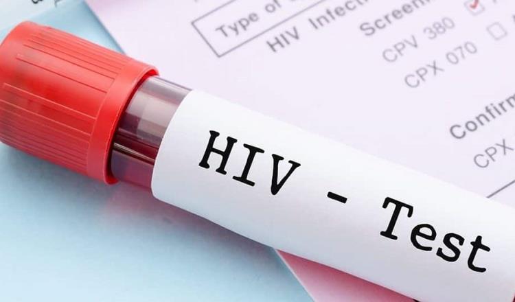 Confirman segundo caso en el mundo de curación de paciente con VIH