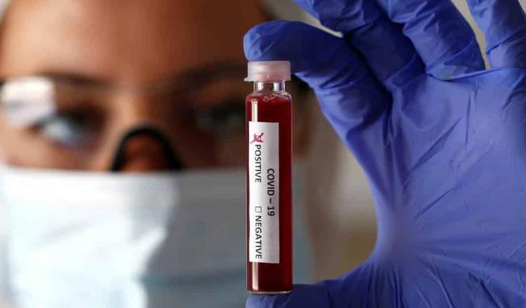 Confirma Secretaría de Salud quinto caso positivo de coronavirus en Tabasco