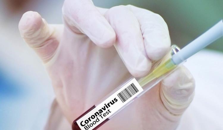 Realiza UNAM pruebas en animales de vacuna contra COVID-19; para 2021 se probaría en humanos
