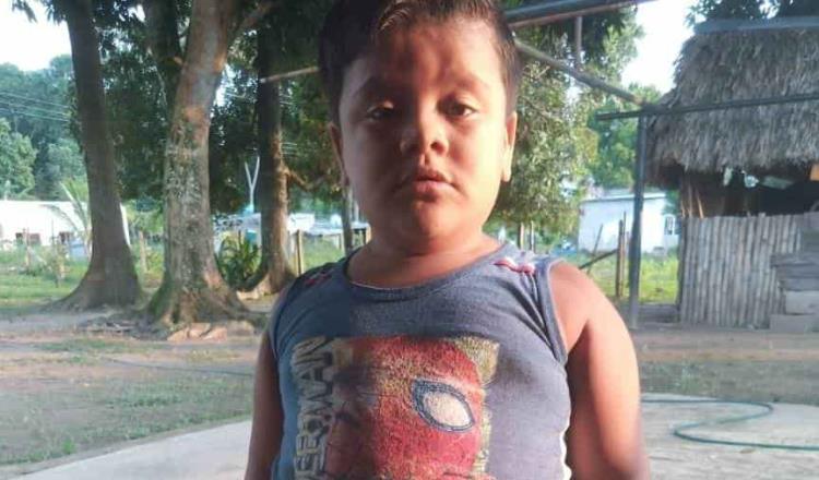 Familiares y amigos piden ayuda para el niño Jhonatan Velázquez Leyva quien padece síndrome obstructivo nasal y requiere ser operado