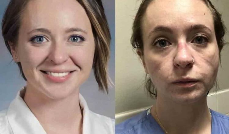 Enfermera estadounidense impacta al mostrar su deterioro físico, luego de 8 meses de estar al frente de la pandemia
