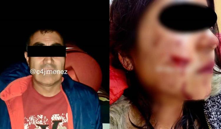 Cortan de la cara a mujer al ser asaltada en la CDMX; detienen a presunto responsable