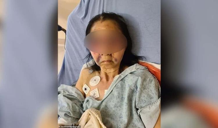 Confunden a abuelita mexicana con asiática y la golpean brutalmente en Los Ángeles