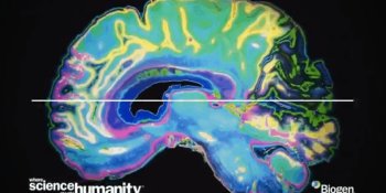 Revela estudio que viajar retrasa aparición de enfermedades cerebrales como el Alzheimer