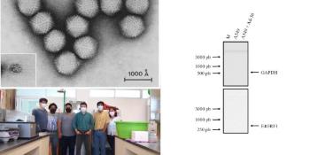 Investigador de la UJAT analiza relación de los virus con la obesidad