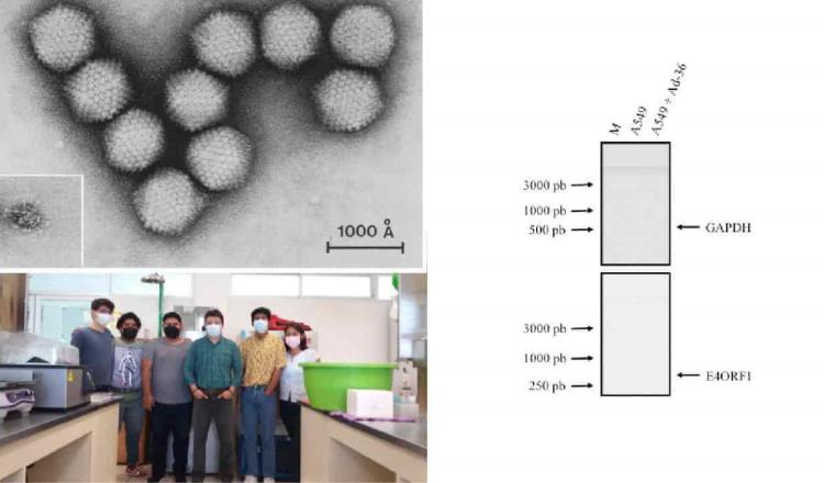 Investigador de la UJAT analiza relación de los virus con la obesidad