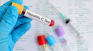Casos de hepatitis aguda infantil podrían estar vinculados a COVID-19: The Lancet