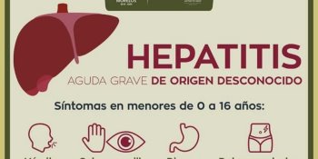 Detecta Morelos primer caso sospechoso de hepatitis aguda grave