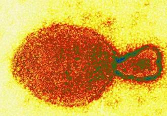 Detectan ahora en China el Henipavirus, es de origen animal; hay 35 contagiados