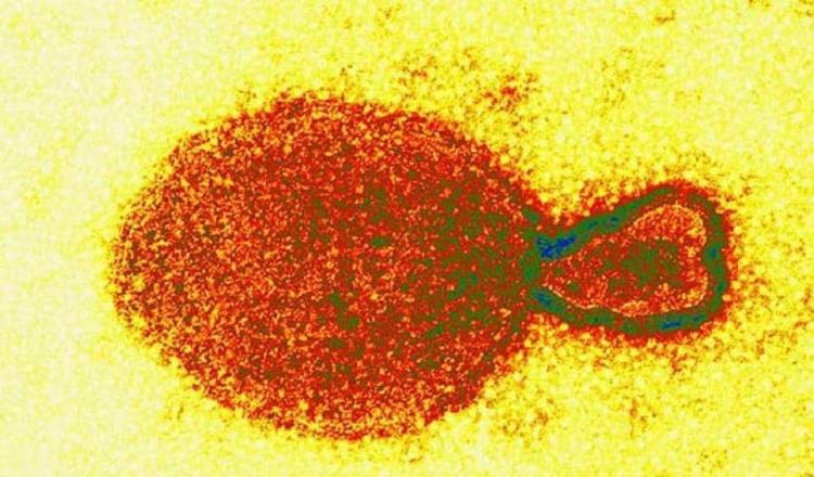 Detectan ahora en China el Henipavirus, es de origen animal; hay 35 contagiados