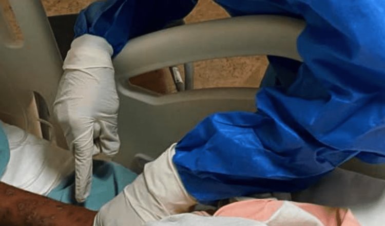 Tabasco mantiene 47 casos acumulados de mpox: Salud