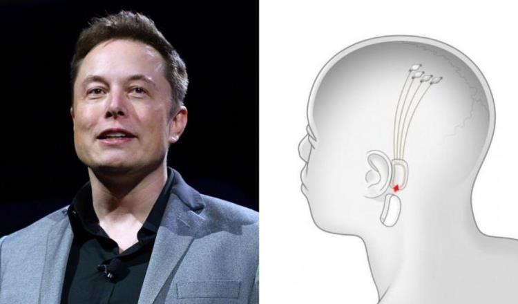 Neuralink, compañía de Elon Musk, colocaría implante cerebral a mediados de 2023 