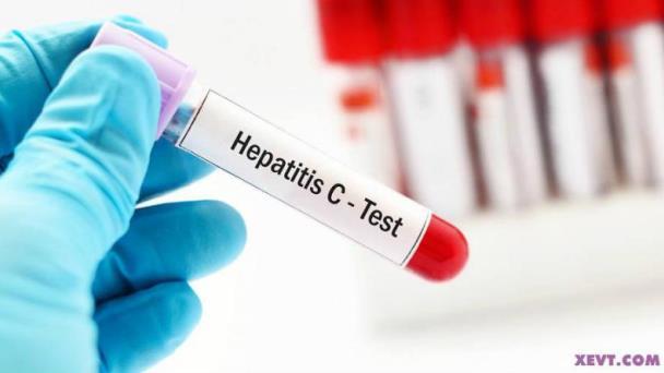 Hepatitis podría ser más mortal que otras enfermedades en 2040: OMS