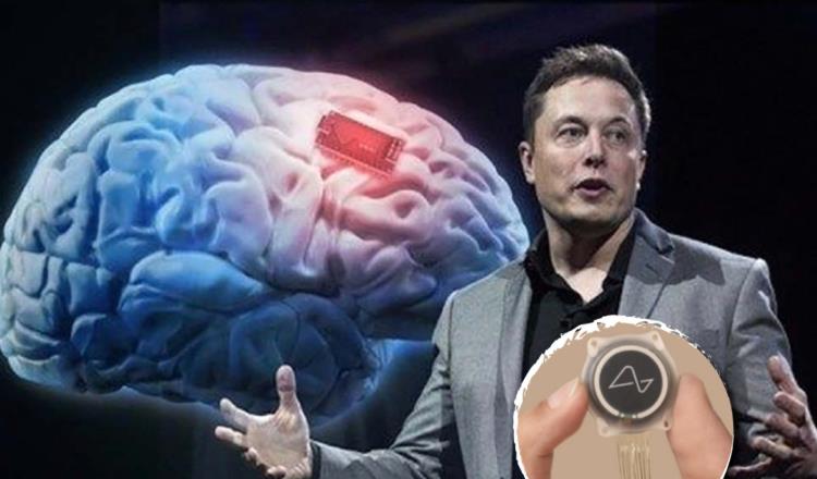 Neuralink, de Elon Musk, ya busca segundo paciente para implantar chip cerebral